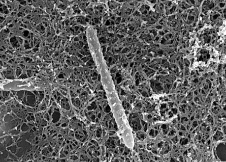 An electron microscope reveals Candidatus Desulforudis audaxviator, a bacterium species found living on its own in a South African gold mine. An analysis of the organism's genome reveals that the bacterium has all the genetic tools it needs to harvest food and build itself from raw materials found in its environment. It is the first organism ever found in nature to live independently from other species.