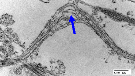 BROKEN AXON: Sudden forces cause microtubules running inside axons to break (arrow), leading to axon swelling and damage, a new study shows. The work may have implications for understanding traumatic brain injury. Credit: D. Smith