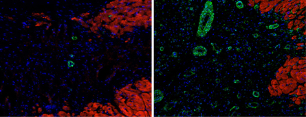 protein scaffold of a heart protein scaffold of a heart