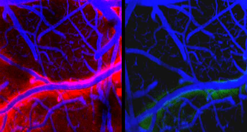 Sleep allows brain to wash out junk