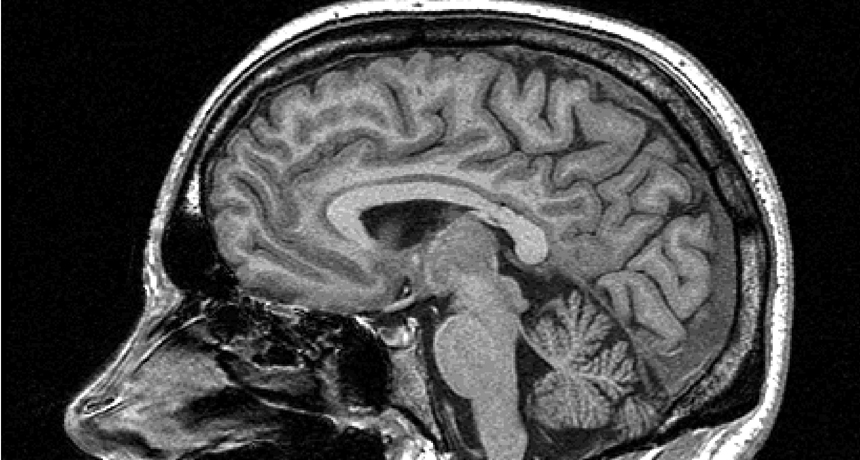 brain scan