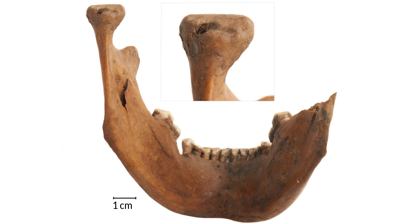 Among the skull remains that researchers have connected to ritual decapitations in Roman London is this lower jaw with a wound, shown in close-up, that was caused by a sharp-edged weapon. © Museum of London