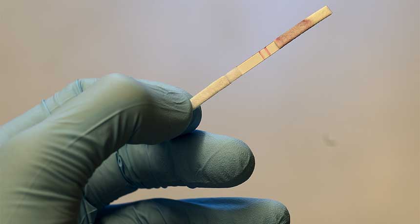 peeing on pregnancy test prostate cancer doppelhertz din prostatită