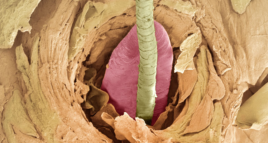 pink tail of mite shown in a hair follicle