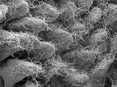 microbes on intestinal cells of a mouse