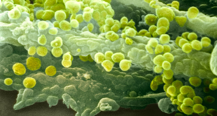 Influenza particles
