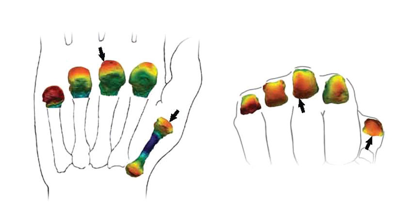 Hand bones