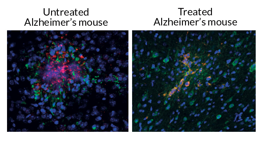 mouse brain cells