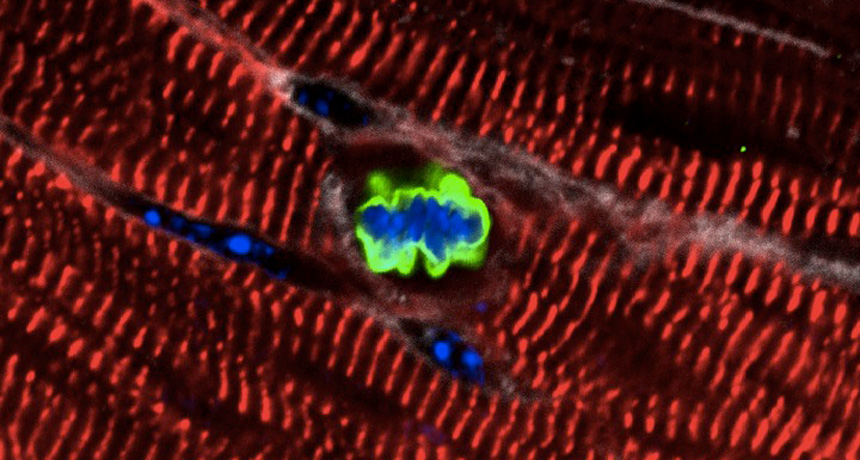 cardiac muscle cells