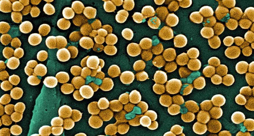 methicillin-resistant Staphylococcus aureus