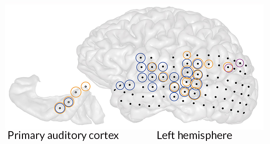 brain activity