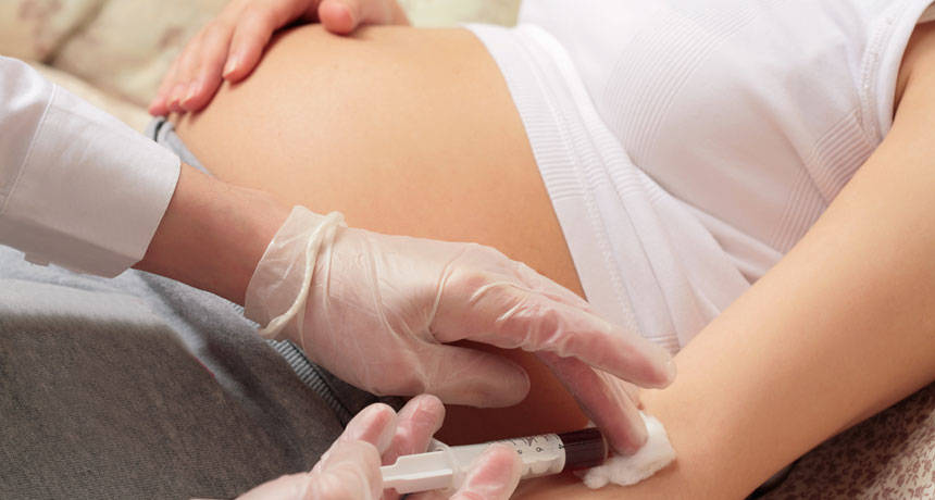 Prenatal Test