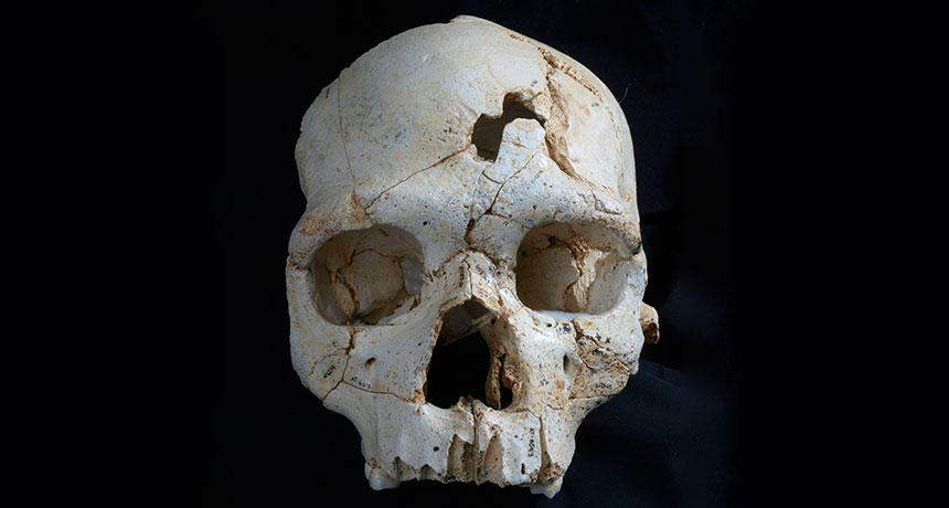 Cranium 17