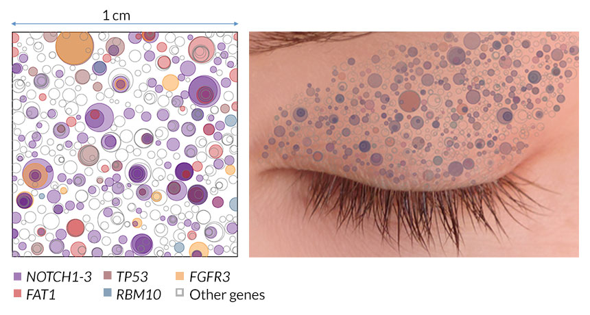 eyelid