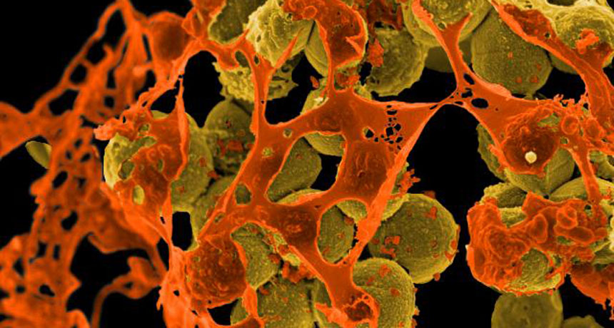MRSA bacteria