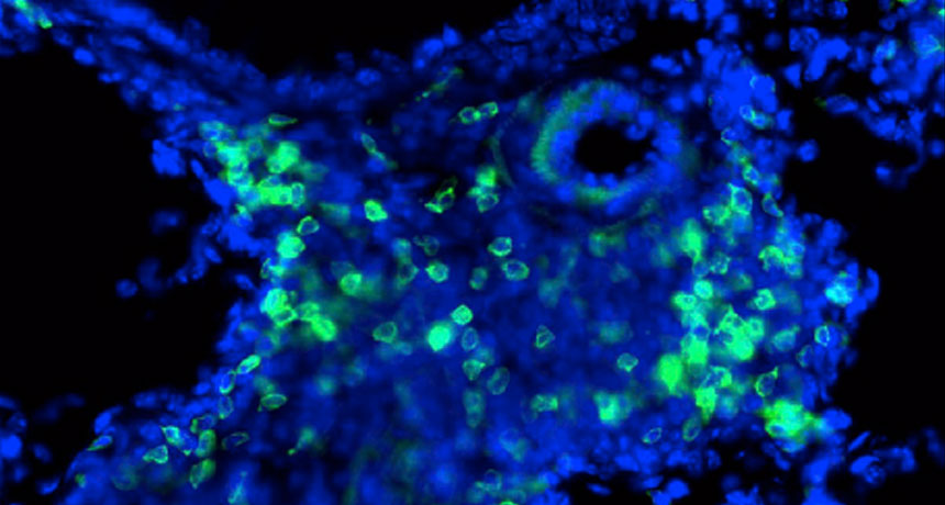 immune cells