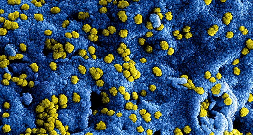 Monkey cell infected with the virus that causes MERS