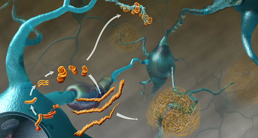 prions and disease