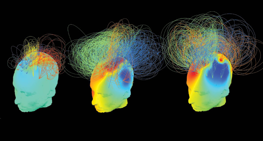 brain neworks