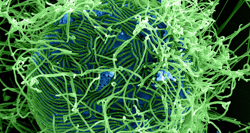 Ebola virus particles (green)