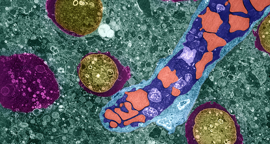 amoebas (yellow); brain (blood vessel and blood cells shown in blue and orange)