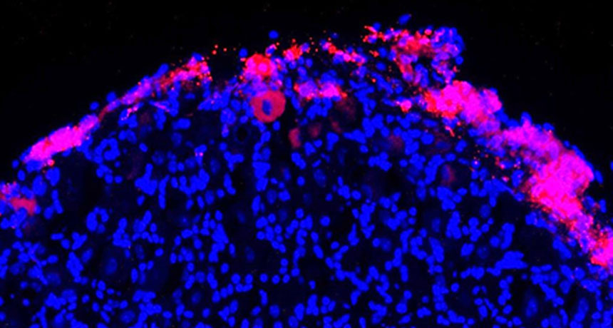 Therapeutic cells (pink)
