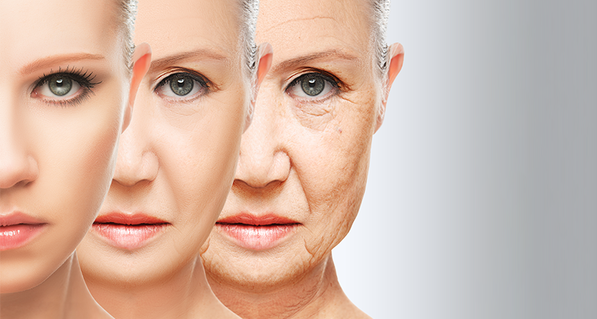 Aging