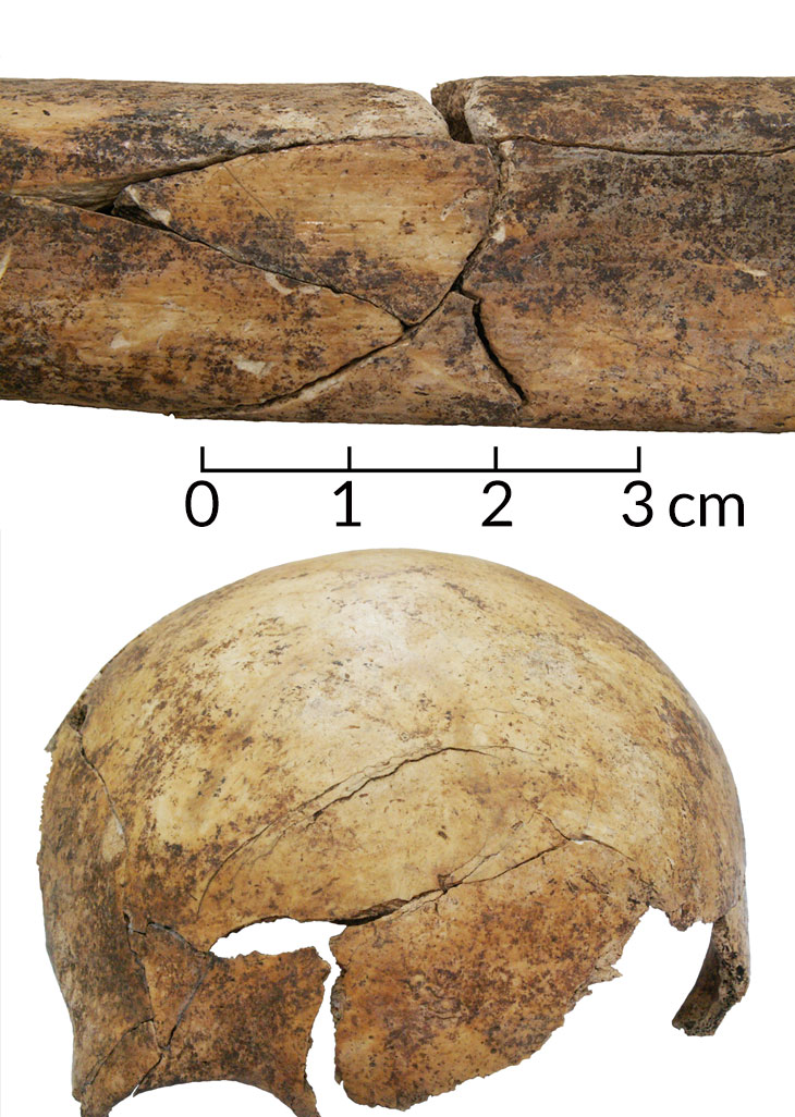 lower leg bone
