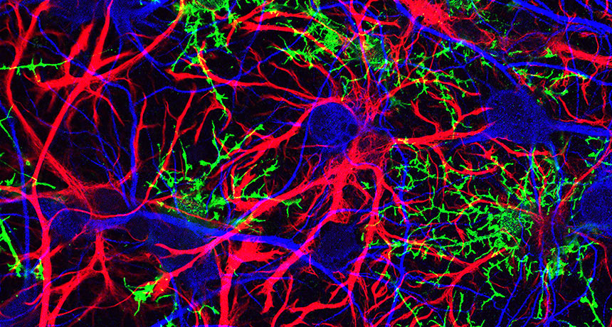 Neurons and glia