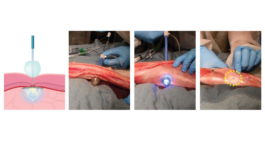 light-activated glue sealing wound in pig tissue