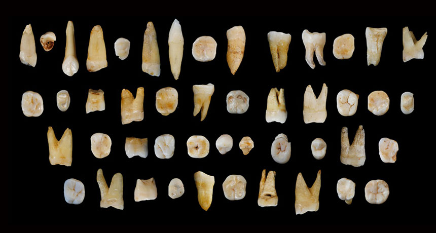 ancient human teeth