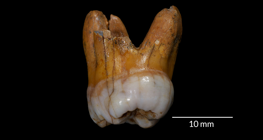 denisovan tooth