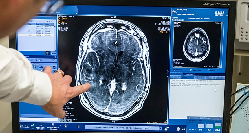 scan of brain of patient