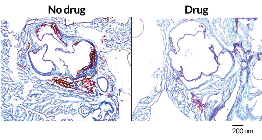 mouse arteries
