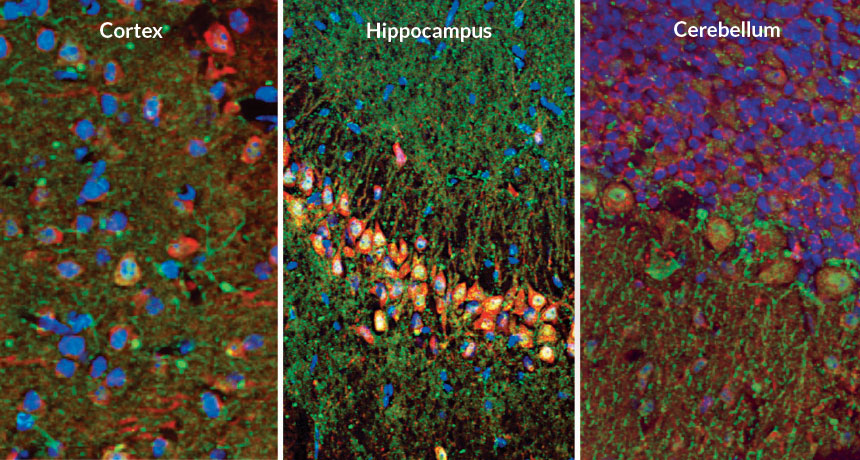 Brain cell nets