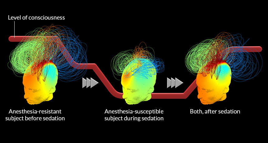 brain scan