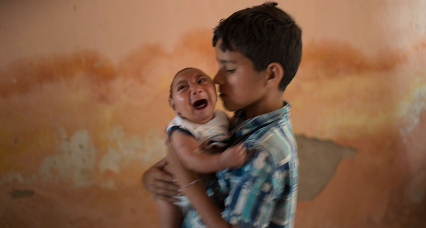 boy holding baby with microcephaly