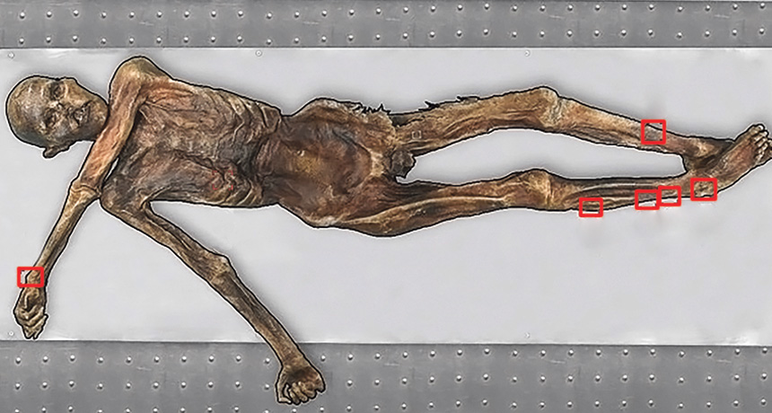 Iceman has the world's oldest tattoos Iceman has the world's oldest tattoos