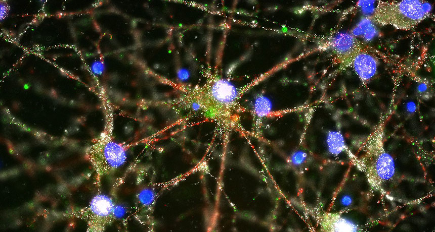 nerve cells