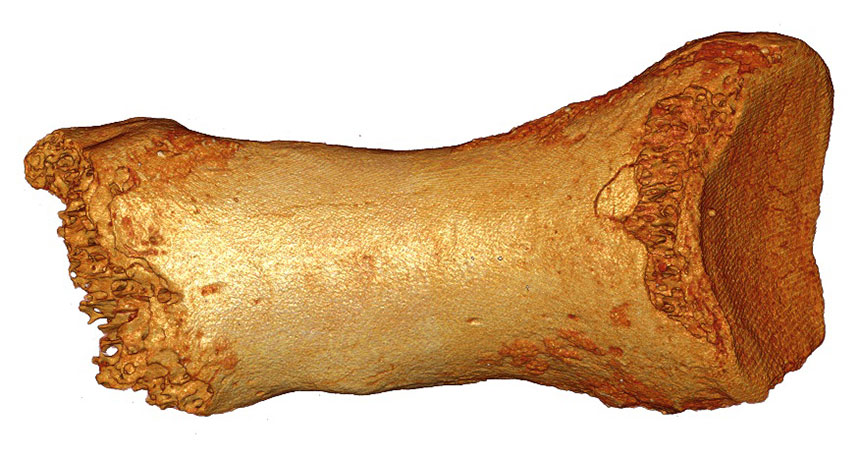 toe bone