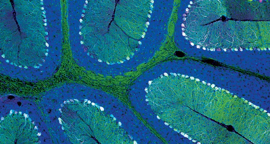 cross-section of a mouse brain
