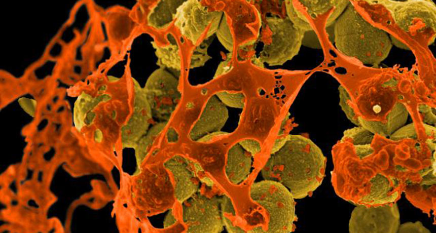 MRSA