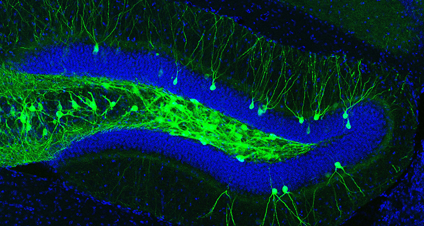 mouse nerve cells