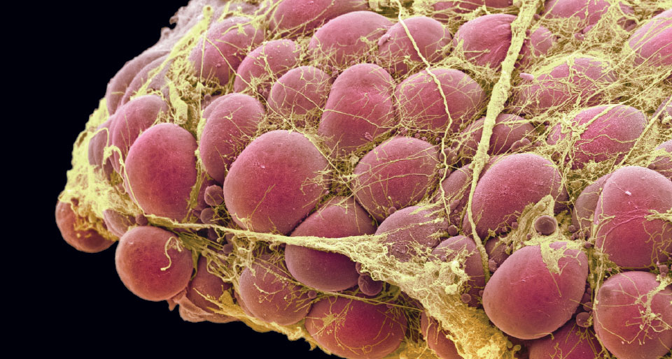 fat stem cells
