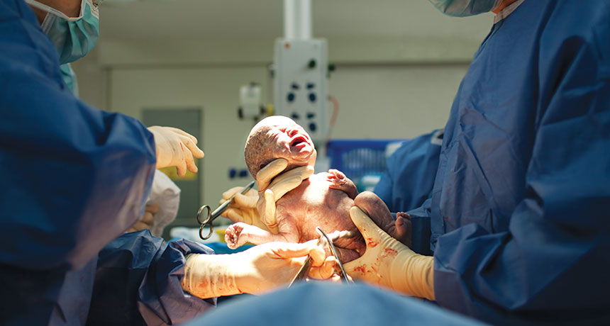 newborn birthed by C-section
