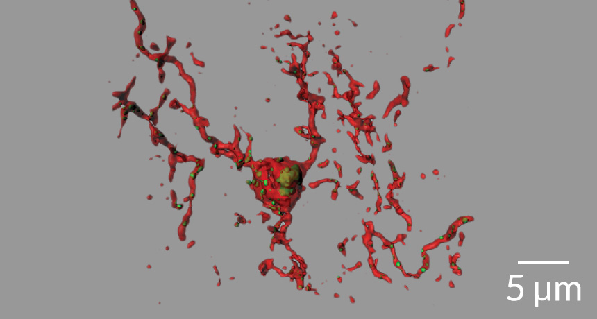Mouse brain cells