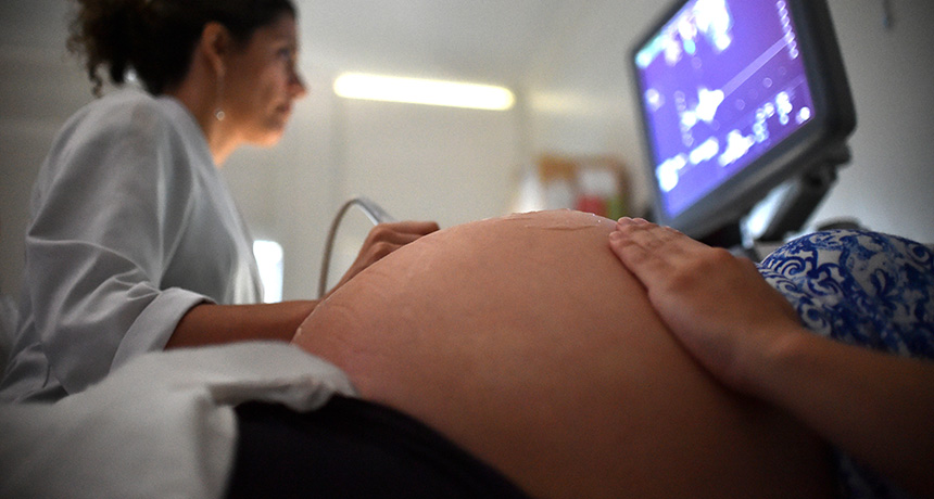pregnant woman having an ultrasound