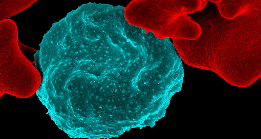 image of malaria parasites infecting red blood cell