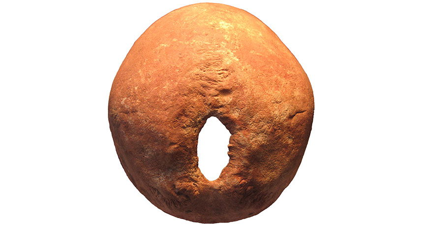 trepanated skull