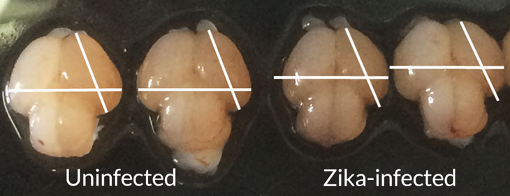 images of fetal mouse brains